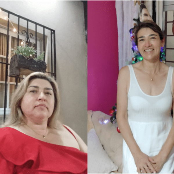 Alicia Ibalo ByPass Gastrico