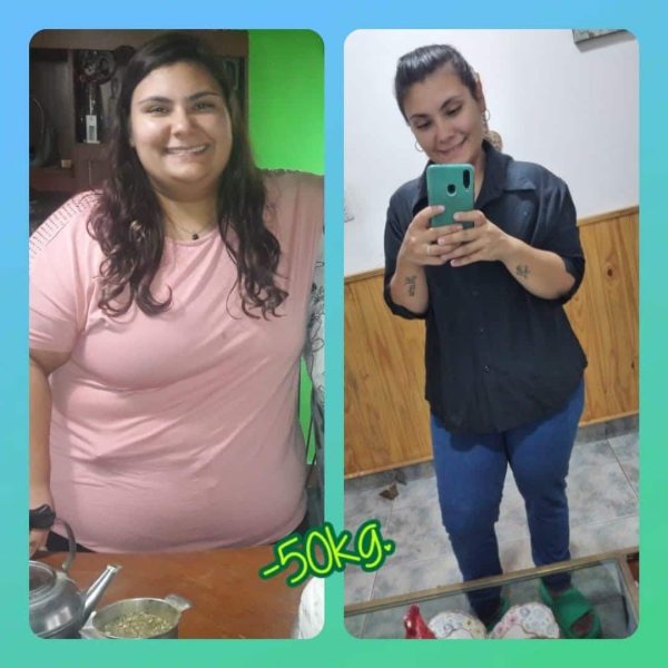 yessica 25 años by pass gastrico